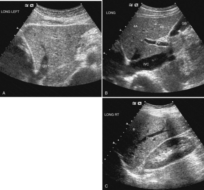 normal liver ultrasound