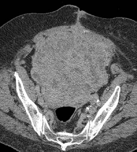 C10FF24A.gif | Abdominal Key