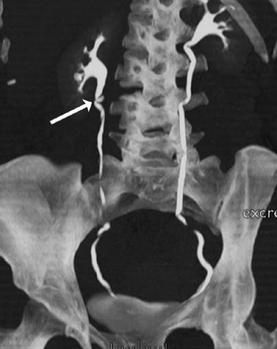 C11FF13B.gif | Abdominal Key