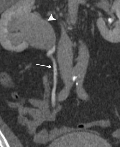 C9FF15B.gif | Abdominal Key