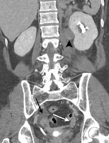 C9FF18D.gif | Abdominal Key