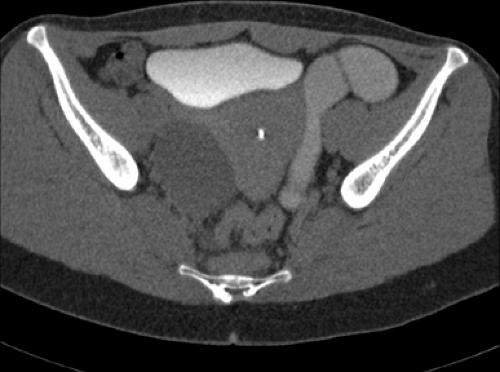 C9FF22C.gif | Abdominal Key