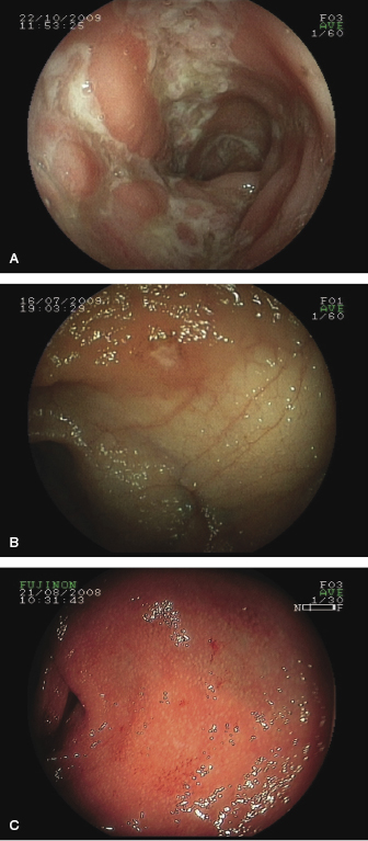 c10-fig-0003