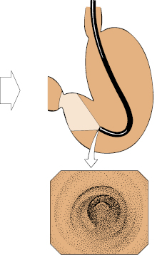 c4-fig-0014