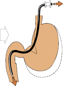 c4-fig-0021.jpg | Abdominal Key