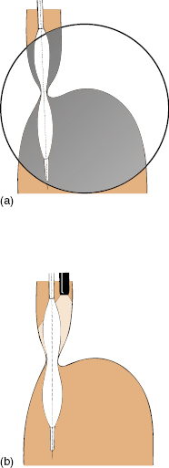 c5-fig-0005