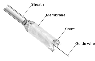 c5-fig-0006