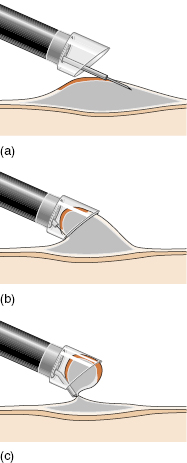 c5-fig-0007