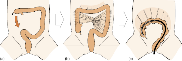 c6-fig-0006