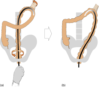 Digestive Key Ring c6-fig-0063.jpg | Abdominal Key