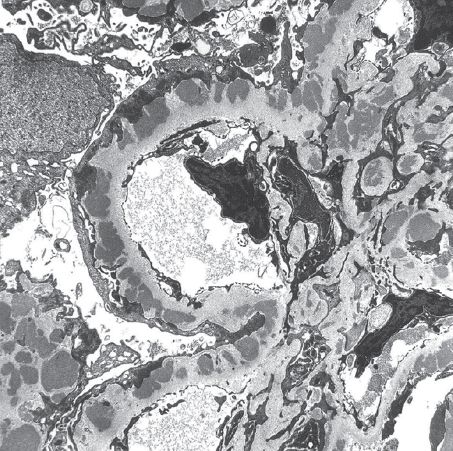 00086 Jpeg Abdominal Key