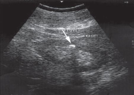 00114 Jpeg Abdominal Key