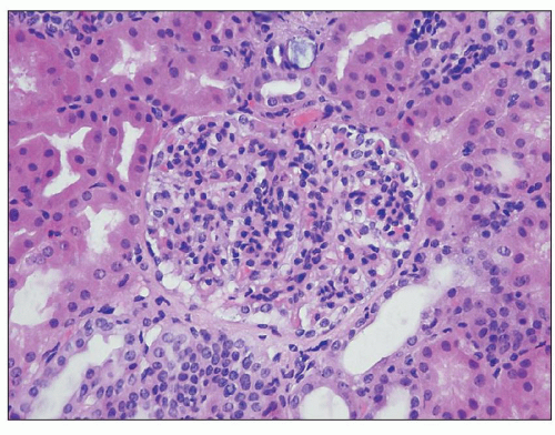 C10-FF38.gif | Abdominal Key