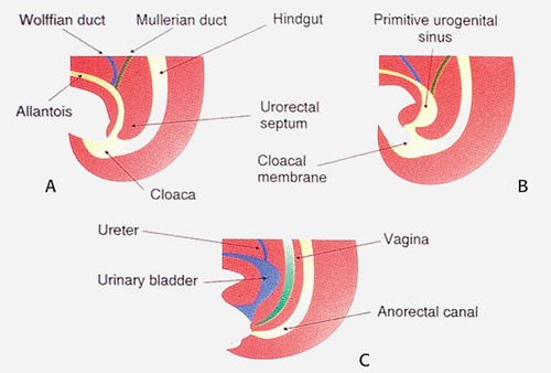 sentinel pile and anal papillae