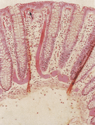 Shell Key Bowel C1FF8.gif | Abdominal Key