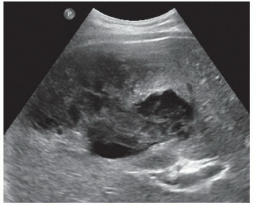 Online Chapter 2 | Abdominal Key