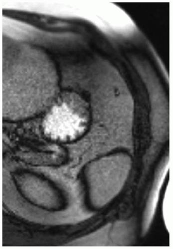 C3-FF252.gif | Abdominal Key