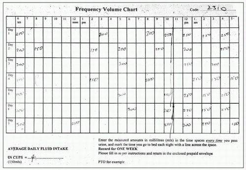 Frequency Voiding Chart