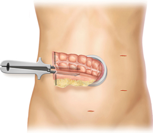 Digestive Key Ring DA1C3FF18.jpg | Abdominal Key