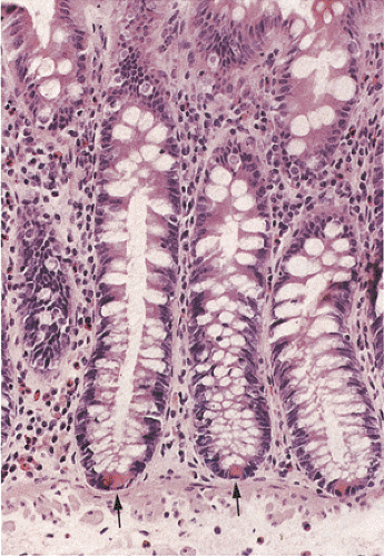 Shell Key Bowel DA2C13FF14.gif | Abdominal Key