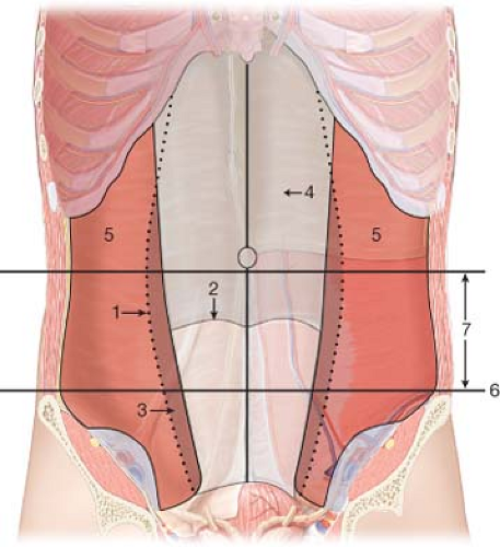 spigelian hernia anatomy