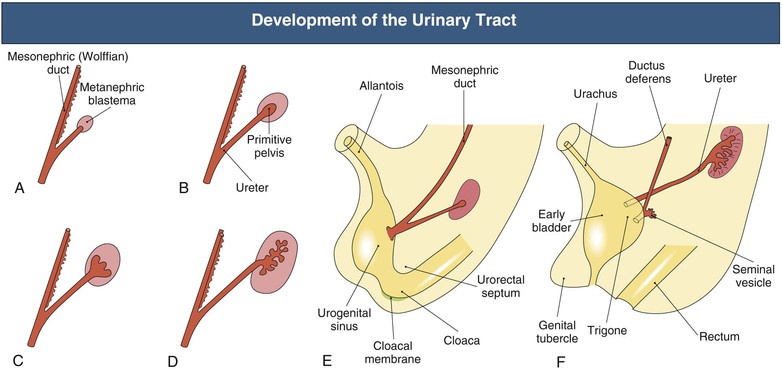 Genital and urinary tract defects