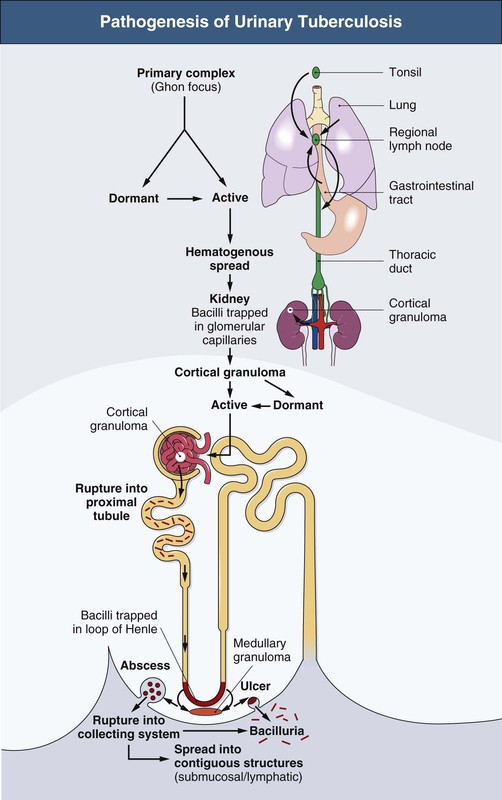 pathogenesis-of-urinary-tract-infections-with-normal-female-anatomy-the