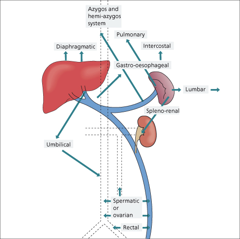 9 The Hepatic Artery, Portal Venous System and Portal Hypertension: the ...