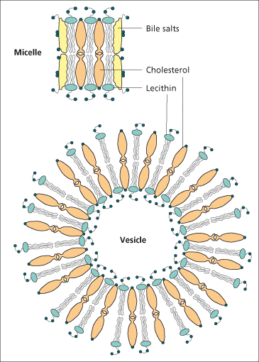 salt bile structure Key Diseases 12 Benign Biliary and Abdominal   Gallstones