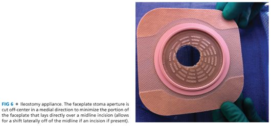 Image00644 Jpeg Abdominal Key