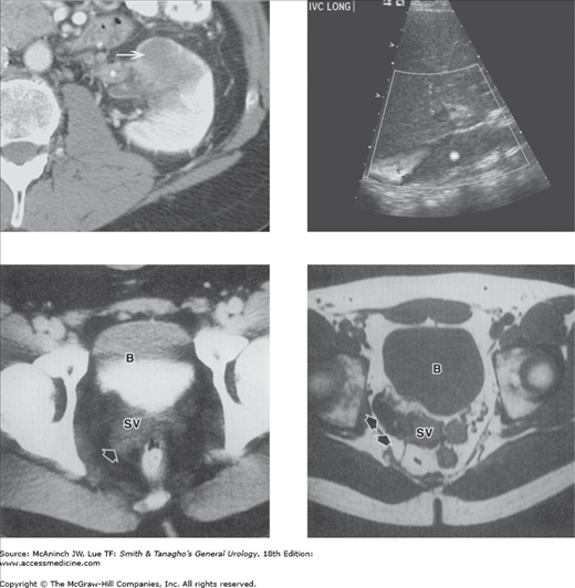 Radiology Of The Urinary Tract | Abdominal Key