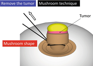 A315716_1_En_3_Fig12_HTML.gif