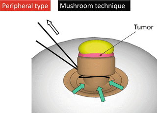 A315716_1_En_3_Fig13_HTML.gif