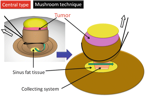 A315716_1_En_3_Fig30_HTML.gif | Abdominal Key