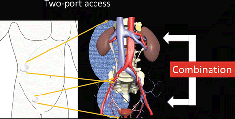 A315716_1_En_4_Fig9_HTML.gif