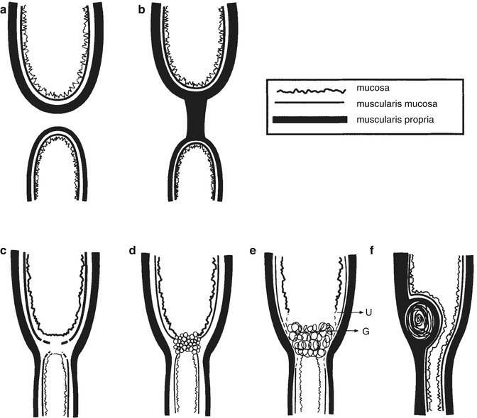 A78406_2_En_1_Fig12_HTML.jpg