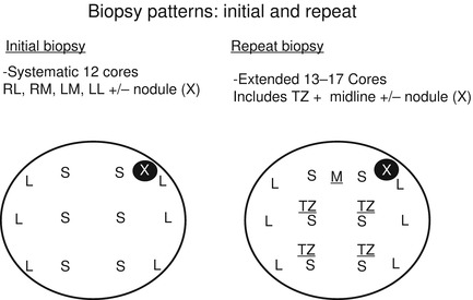 Clinical Presentation, Diagnosis and Staging | Abdominal Key