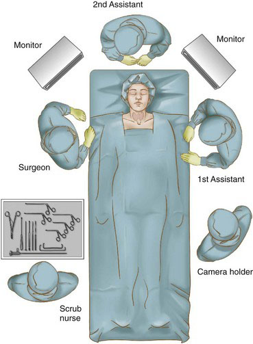 Minimally Invasive Video Assisted Thyroidectomy Abdominal Key