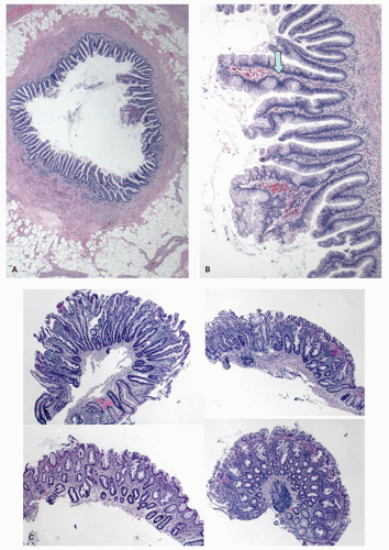 C15-FF37.gif | Abdominal Key