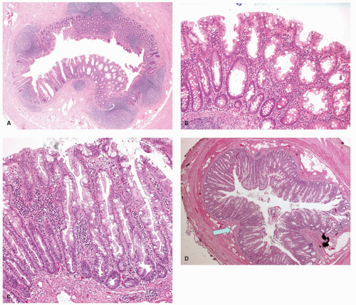 C15-FF39.gif | Abdominal Key