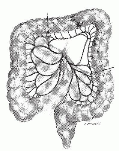 C23-FF44.gif | Abdominal Key