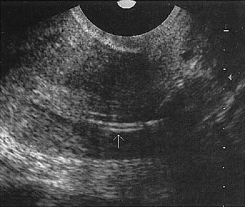 DA1C3FF17.gif | Abdominal Key