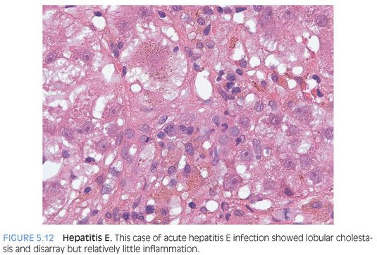 Image00470 Jpeg Abdominal Key