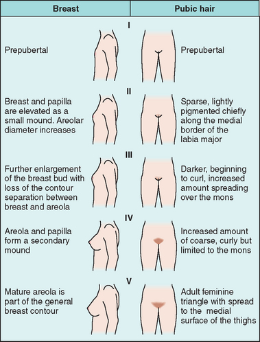 This line drawing of the Tanner Stages maturation of women's breasts