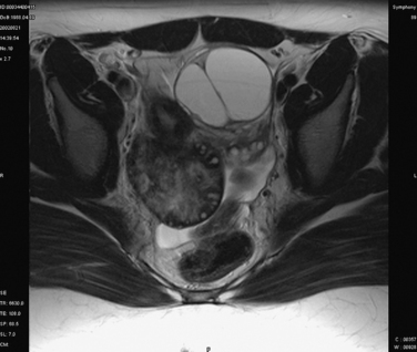 B9780323033091500173_gr4.jpg | Abdominal Key