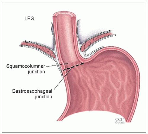 Esophageal Testing Abdominal Key   C2 FF13 