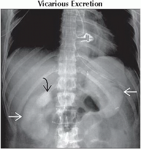 DA10-DB2-High_Attenuation_Hyperdense_Bile_in_Gallbladder-FFU2.gif ...
