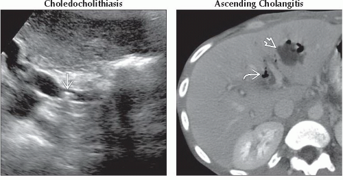 DA10-DB3-Right_Upper_Quadrant_Pain-FFU4.gif | Abdominal Key