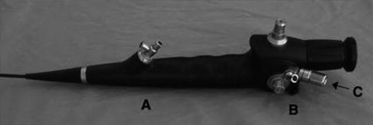 Flexible Ureteroscopes: Fiberoptic And Digital | Abdominal Key