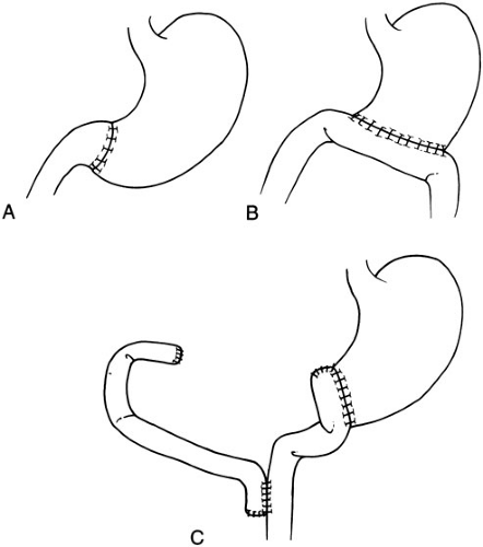 C7-FF1.gif | Abdominal Key